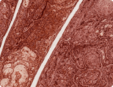 DAB Stained Tissue Analysis