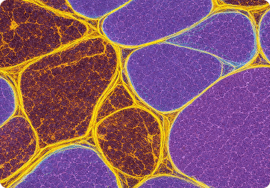 Phase & Microstructure