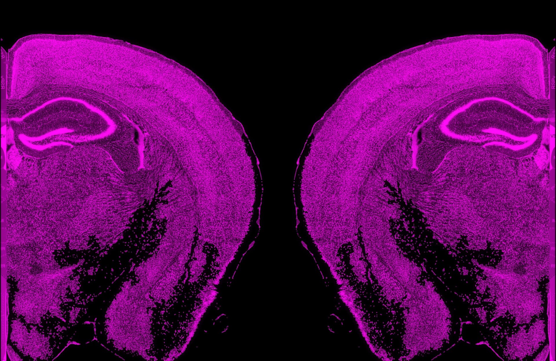Brain Atlas Registration