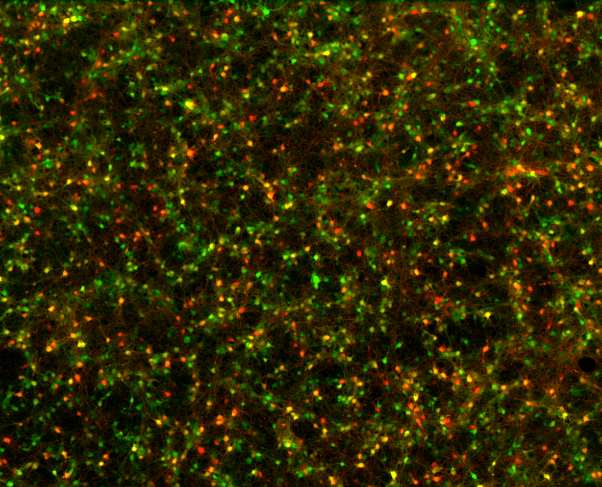 Fluorescence Colocalization