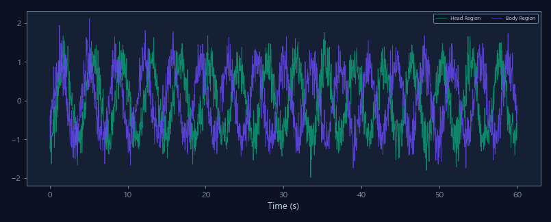ROI-specific motion energy