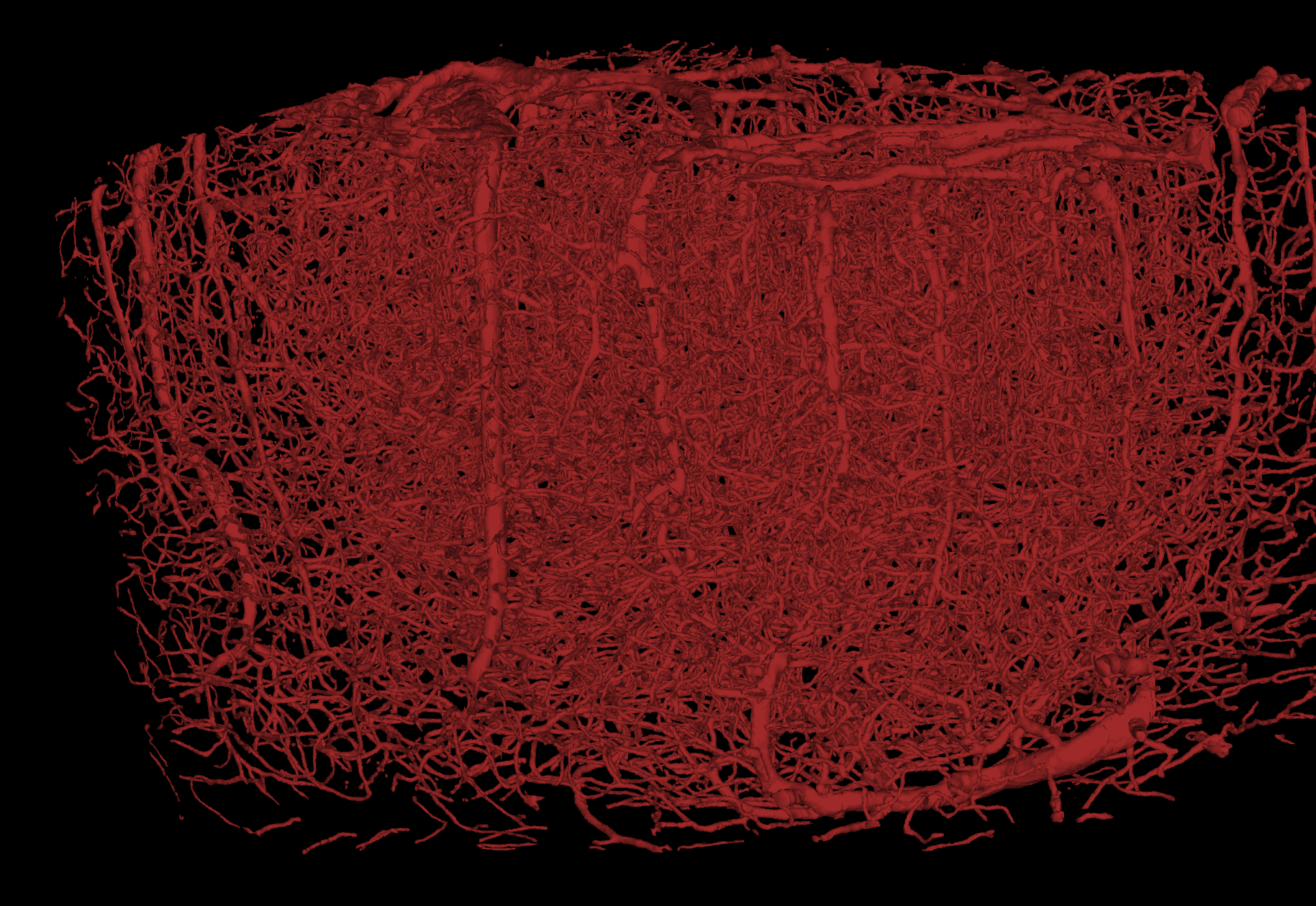 Vessel Reconstruction
