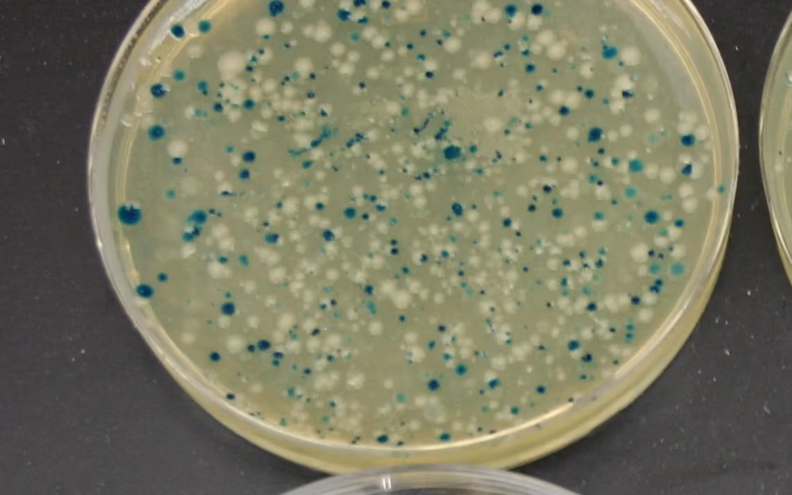 Colony plate image prepared for ConductVision colony counting