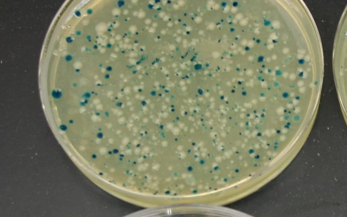 Colony plate image prepared for ConductVision colony counting