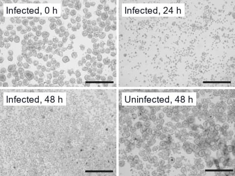 Brightfield images of airway organoids 0, 24 and 48 hours after infection with a respiratory virus, breaking up over that time, beside mock-infected organoids at 48 hours.