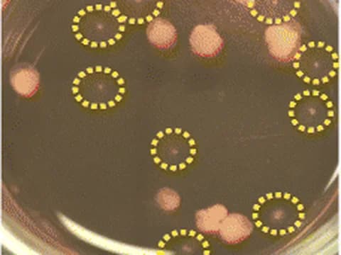 Cerebral organoids carrying a CLN3 mutation in a culture dish after 55 days of differentiation, with the small, underdeveloped ones circled in yellow by the authors.
