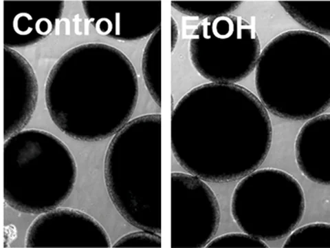 Microscope images of human cortical organoids, untreated controls beside organoids exposed to ethanol, which are smaller.