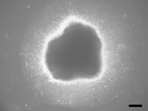 Microscope image of an untreated human cerebral organoid on day 42: a dark, lobed organoid in the Matrigel it was embedded in.