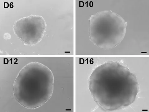 Microscope images of human cerebral organoids on days 6, 10, 12 and 16, growing larger, with loops of neuroepithelium along their edges.
