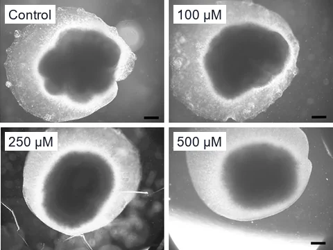 Microscope images of human cerebral organoids on day 56, untreated and after 100, 250 or 500 µM valproic acid, the organoids smaller at the two higher doses.