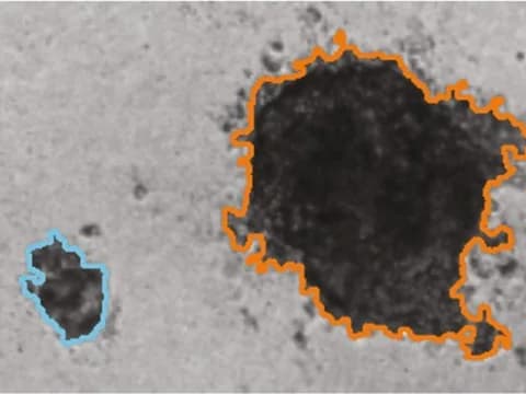 Brightfield image of triple-negative breast cancer spheroids outlined by OrganoSeg, a published tool, one large and irregular beside a small, rounder one.