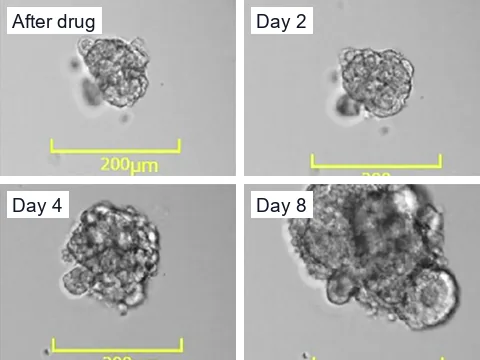Brightfield images of colorectal cancer organoids grown from a patient-derived cell line, just after SN-38 treatment and on regrowth days 2, 4 and 8, growing back without the drug.