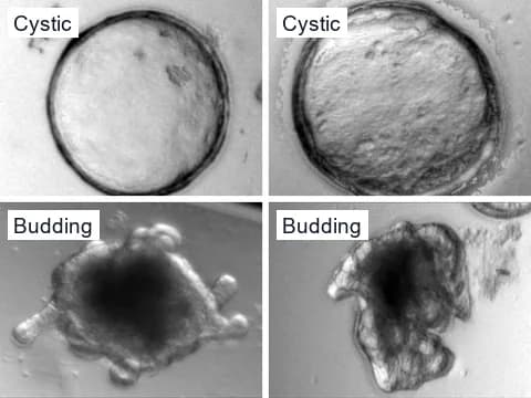 Microscope images of mouse colon organoids on day 6 of culture, two round, cystic colonospheres above and two colonoids with buds extending into the gel below.