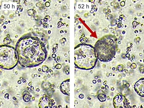Microscope images of colorectal cancer organoids at 50 and 52 hours of culture, in which a swollen, hollow organoid collapsed into a small dark mass, marked by the authors' arrow.