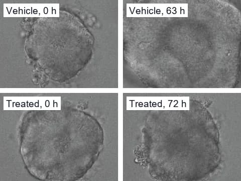 Transmitted-light stills from three days of time-lapse imaging of patient-derived colorectal cancer organoids with mutant KRAS, one given vehicle, which grew, and one given afatinib and selumetinib, which kept its size.