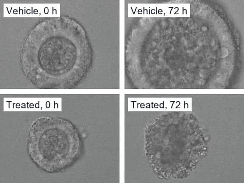 Transmitted-light stills from three days of time-lapse imaging of patient-derived colorectal cancer organoids, one given vehicle, which grew, and one given afatinib and selumetinib, which lost its smooth outline.