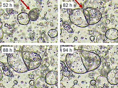 Microscope images of colorectal cancer organoids at 52, 82, 88 and 94 hours of culture, in which a collapsed organoid swelled again and fused with its neighbor into one.