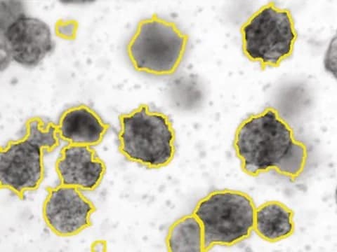 Brightfield image of colorectal cancer organoids, round and irregular, each outlined in yellow by OrganoSeg, a published tool.