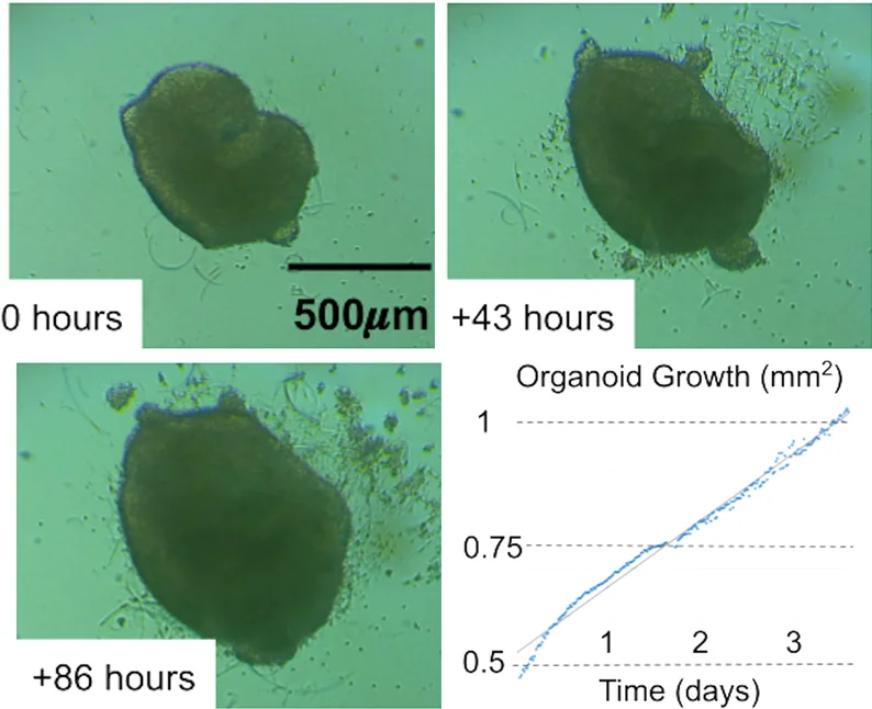 Brightfield camera images of one human cortical organoid at 0, 43 and 86 hours, growing larger, beside a chart of its area rising over the same period.