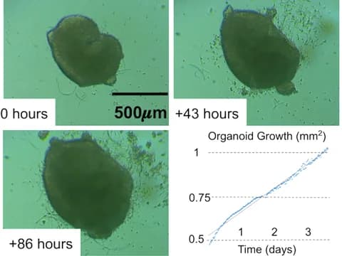 Images of one human cortical organoid taken inside an incubator at 0, 43 and 86 hours, growing larger, beside a chart of its area at each time point.