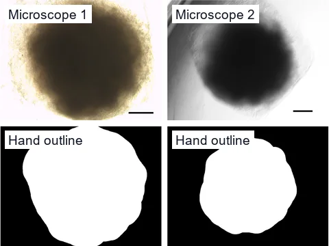 A brain organoid from the tyrosine hydroxylase deficiency line on day 30, imaged on two brightfield microscopes in separate laboratories, above each image's outline drawn by hand as a white shape.