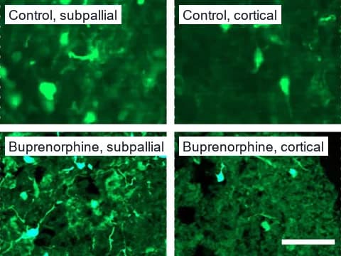 Fluorescence images of fused human brain spheroids with interneurons labeled by green GFP, on the subpallial side where they start and the cortical side they migrate into. One spheroid is a control and one was exposed to buprenorphine.