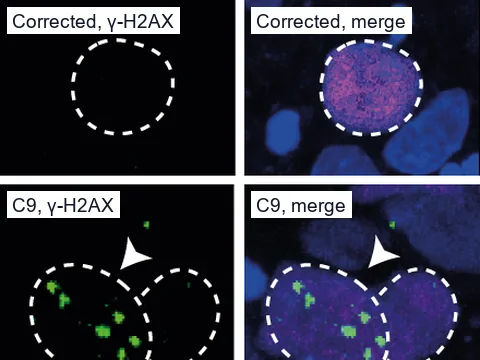 Fluorescence images of deep-layer neuron nuclei in brain organoid slices, outlined with dashed circles. Green γ-H2AX DNA damage foci show in a C9orf72 line and are absent in its gene-corrected control; the merges add CTIP2 in magenta and DAPI in blue.