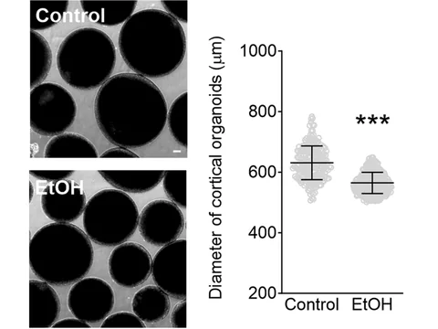 Microscope images of human cortical organoids, control above and ethanol-exposed below, beside a dot plot of organoid diameter in micrometers in which the ethanol group is lower.