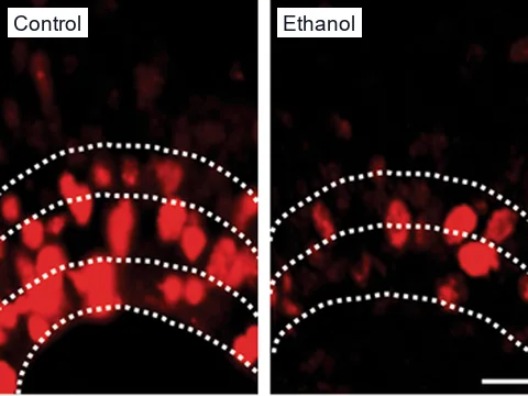 Fluorescence images of sections of a control and an ethanol-exposed human cortical organoid stained for Ki67, with Ki67-positive cells in red and dotted lines marking their layers.