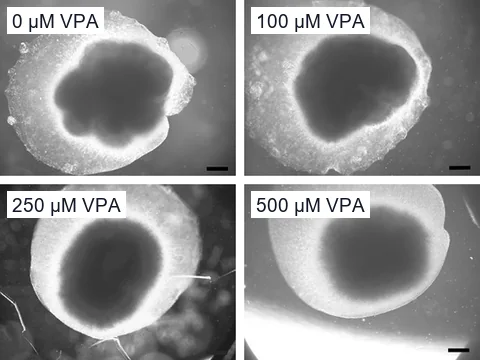 Grayscale microscope images of four human dorsal forebrain organoids on day 56 after exposure to 0, 100, 250 or 500 µM valproic acid from day 16. The organoids at 250 and 500 µM look smaller.
