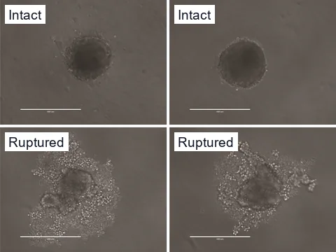 Phase-contrast images of human endothelial cell spheroids on day 10, two still whole and two ruptured, with cells escaping from them.