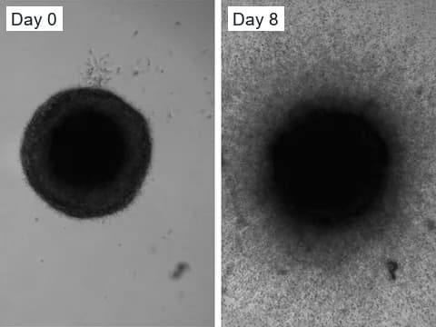 Light-microscope images of the same glioma spheroid in a collagen invasion assay on day 0 and day 8, when cells had spread far into the gel around its dense core.