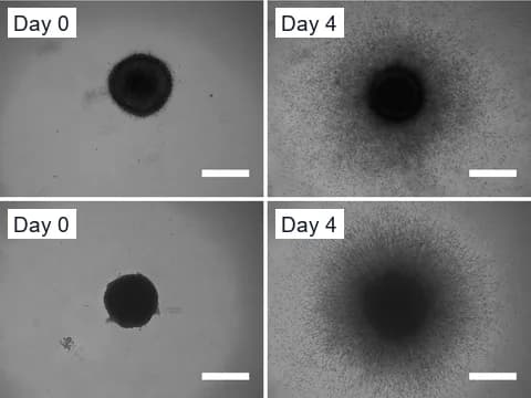 Light-microscope images of glioma cell line spheroids in collagen on day 0 and day 4, compact at first and then ringed by a wide halo of cells invading the gel.