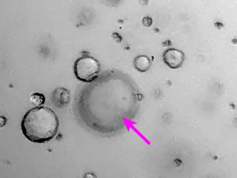 Brightfield image of human intestinal organoids, one of them out of focus and marked by an arrow.