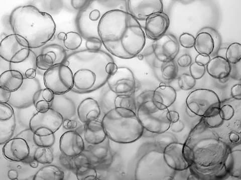 Low-magnification brightfield image of dozens of round, thin-walled human intestinal organoids of many sizes, several overlapping and some out of focus.