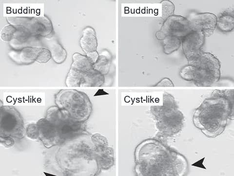 Differential interference contrast images of mouse intestinal organoids, control organoids with buds above and mutant organoids that lost their buds and turned cyst-like below.