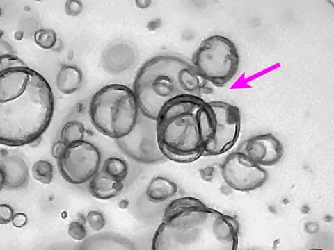 Brightfield image of human intestinal organoids that overlap and hide one another, with one overlap marked by an arrow.