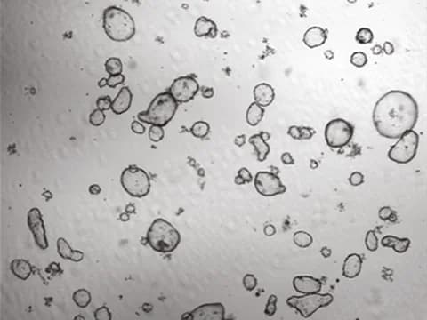 Human intestinal organoids in transmitted light, the dye-free imaging that OrgaSegment, a published tool, was built to analyze.