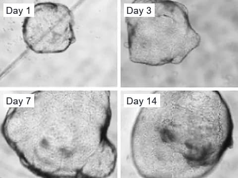 Phase-contrast images of an untreated cyst in a polycystic kidney disease organoid on days 1, 3, 7 and 14, growing from a small sphere to one that fills the frame.