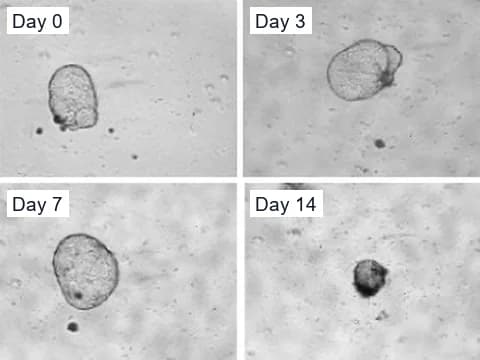 Phase-contrast images of one polycystic kidney disease organoid cyst given 10 µM everolimus on days 0, 3, 7 and 14, still round on day 7 and small and dark by day 14.