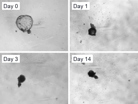 Phase-contrast images of one polycystic kidney disease organoid cyst given 30 µM everolimus on days 0, 1, 3 and 14, shrinking from a round cyst to a small dark mass by day 1.