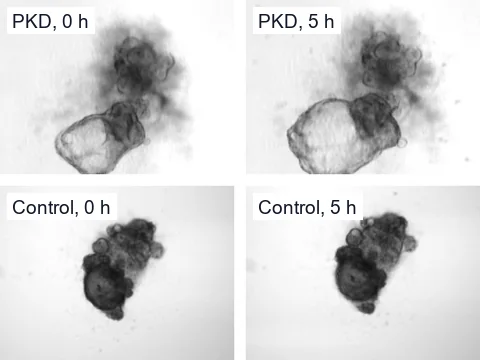 Phase-contrast images of a PKD kidney organoid and a control organoid under fluid flow at 0 and 5 hours, in which the PKD organoid's cyst grew and the control did not swell.