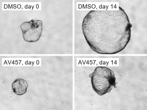 Phase-contrast images of polycystic kidney disease organoid cysts on days 0 and 14, one given DMSO, which grew large, and one given AV457, which stayed smaller.