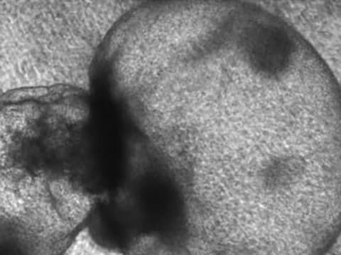 Microscope image of one large, translucent cyst on day 58 of culture in PKD2 knockout kidney organoids.