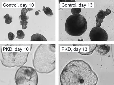 Microscope images of control and PKD1 knockout kidney organoids in suspension culture on days 10 and 13, where the knockout organoids formed large cysts.
