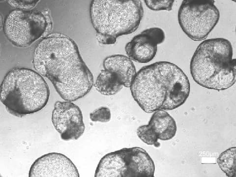Microscope image of kidney organoids, many swollen into large translucent cysts with a darker patch of tissue at one side, and a 250 µm scale bar at lower right.