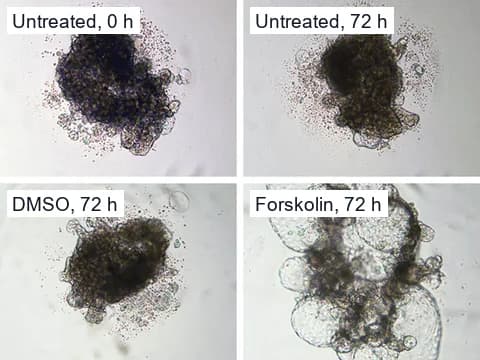 Brightfield images of human kidney tubuloids in suspension, untreated at 0 and 72 hours and given DMSO or forskolin at 72 hours, where the forskolin tubuloids show larger cysts.