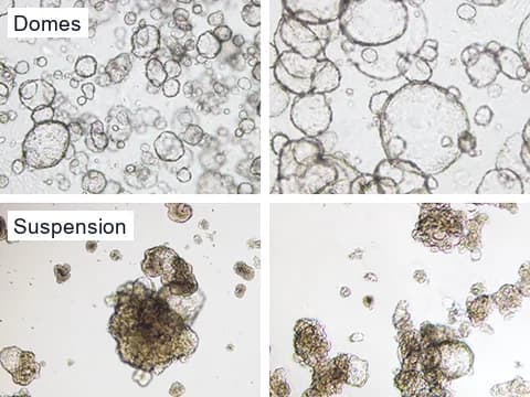 Brightfield images of human kidney tubuloids grown in collagen domes, most of them round with smooth outlines, and grown in suspension, where they form irregular, folded clusters.