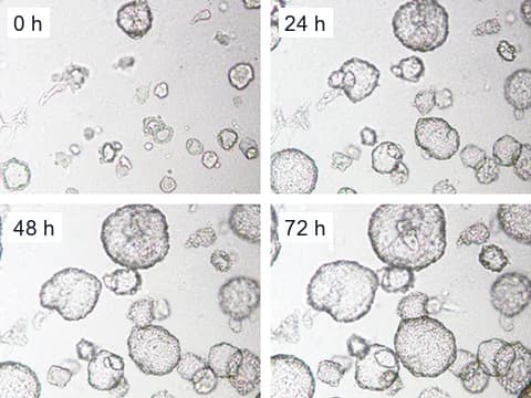 Brightfield images of human kidney tubuloids grown in collagen domes with forskolin, at 0, 24, 48 and 72 hours, as their cysts grow larger.