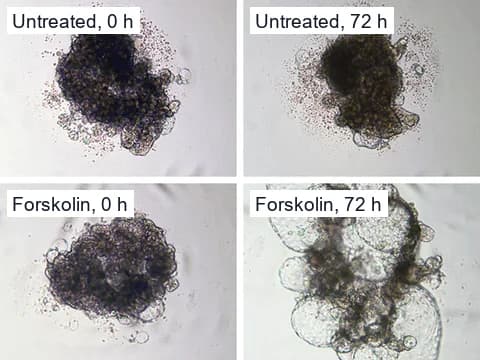 Brightfield images of human kidney tubuloids at 0 and 72 hours, in medium only in the top row and with forskolin in the bottom row, where cysts grew.